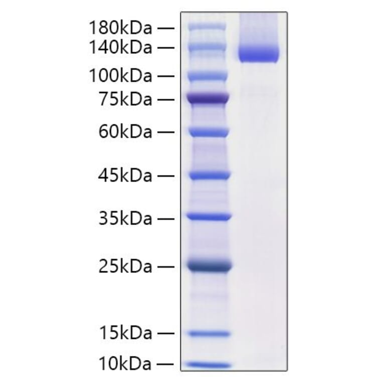 SDS-PAGE - Recombinant Mouse Neuropilin-1 Protein (C-terminal His Tag) (A331438) - Antibodies.com