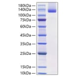SDS-PAGE - Recombinant Mouse Neuropilin-1 Protein (C-terminal His Tag) (A331438) - Antibodies.com