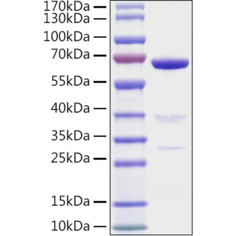 SDS-PAGE - Recombinant Mouse CD73 Protein (C-terminal His Tag) (A331440) - Antibodies.com