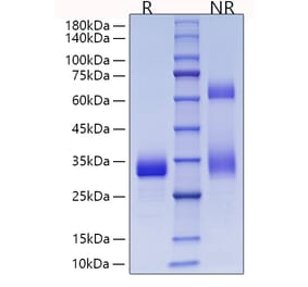 SDS-PAGE - Recombinant Mouse Adiponectin Protein (C-terminal His Tag) (A331441) - Antibodies.com