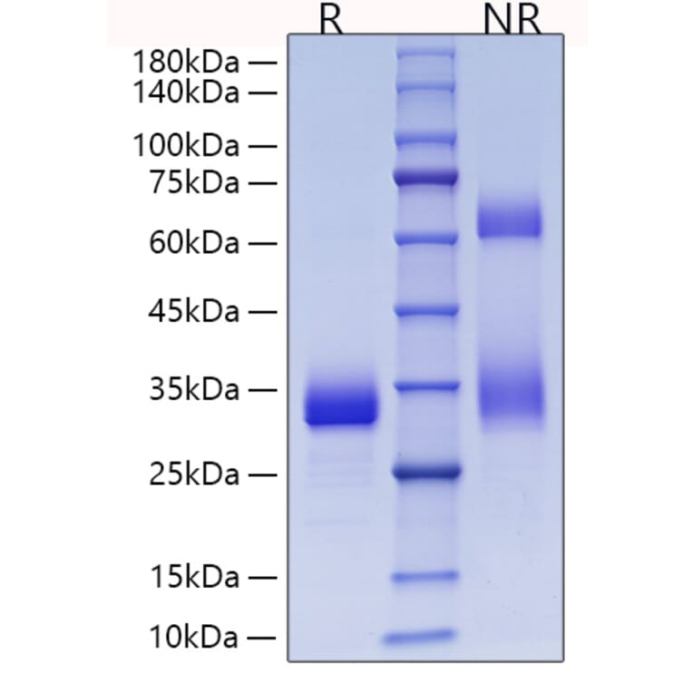 SDS-PAGE - Recombinant Mouse Adiponectin Protein (C-terminal His Tag) (A331441) - Antibodies.com