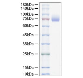 SDS-PAGE - Recombinant Mouse CD166 Protein (C-terminal His Tag) (A331443) - Antibodies.com