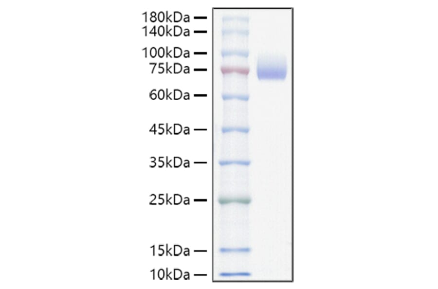 SDS-PAGE - Recombinant Mouse CD166 Protein (C-terminal His Tag) (A331443) - Antibodies.com