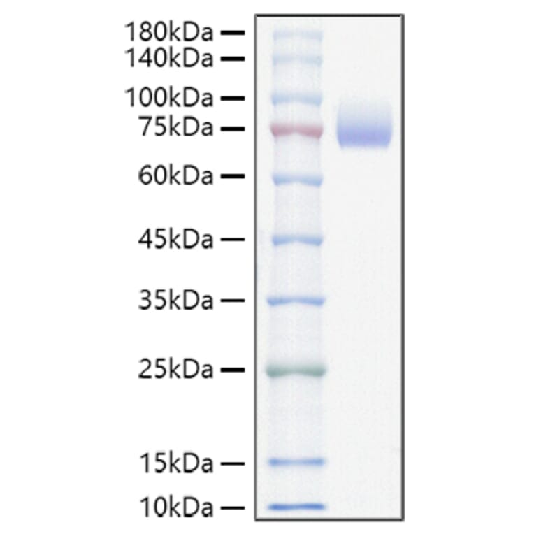 SDS-PAGE - Recombinant Mouse CD166 Protein (C-terminal His Tag) (A331443) - Antibodies.com