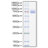SDS-PAGE - Recombinant Mouse CD166 Protein (C-terminal His Tag) (A331443) - Antibodies.com