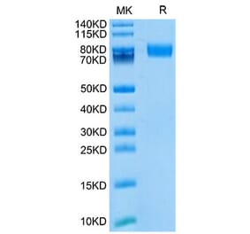 Tris-Bis PAGE - Recombinant Mouse CD166 Protein (Biotin) (C-terminal His and Avi Tag) (A331444) - Antibodies.com