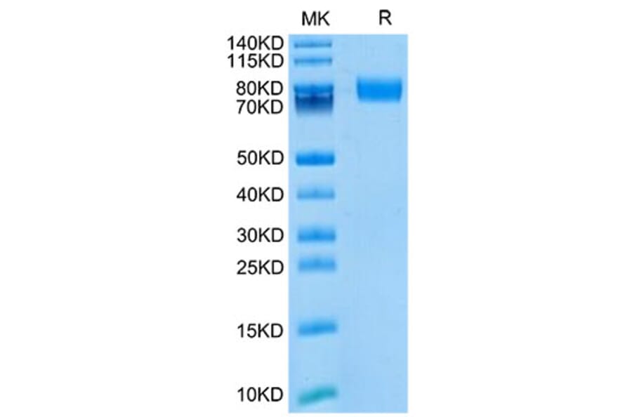 Tris-Bis PAGE - Recombinant Mouse CD166 Protein (Biotin) (C-terminal His and Avi Tag) (A331444) - Antibodies.com