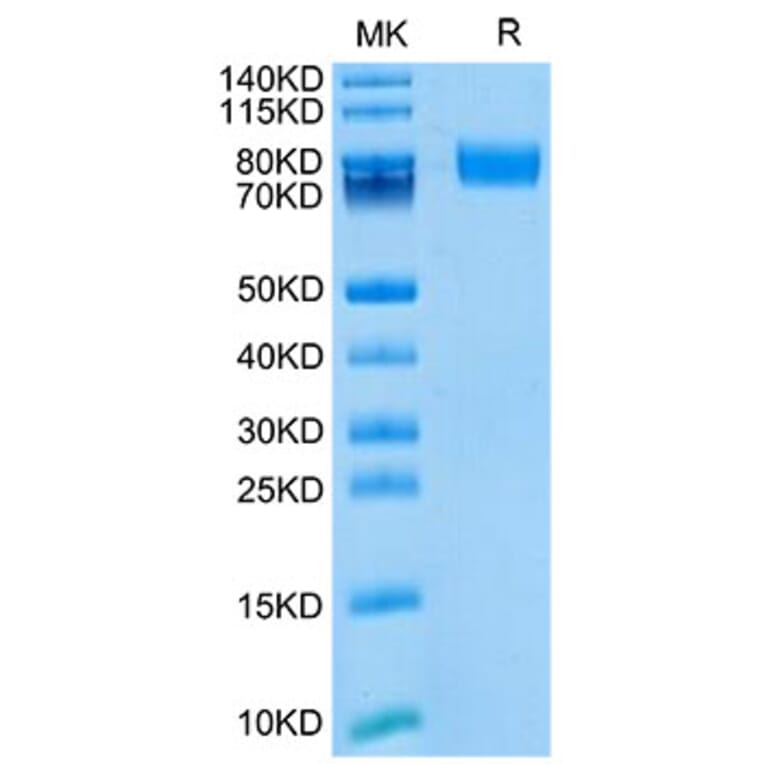 Tris-Bis PAGE - Recombinant Mouse CD166 Protein (Biotin) (C-terminal His and Avi Tag) (A331444) - Antibodies.com