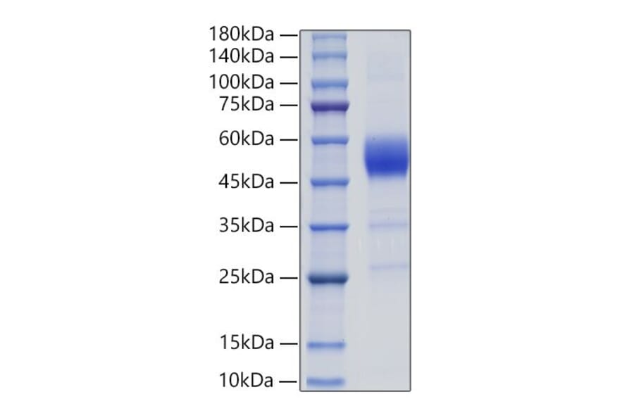 SDS-PAGE - Recombinant Rat ALK-1 Protein (C-terminal Human Fc Tag) (A331445) - Antibodies.com