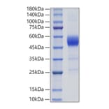SDS-PAGE - Recombinant Rat ALK-1 Protein (C-terminal Human Fc Tag) (A331445) - Antibodies.com