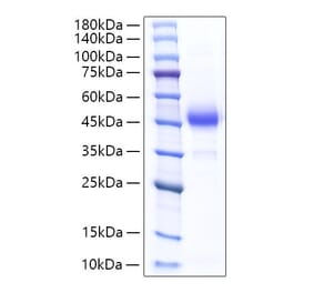 SDS-PAGE - Recombinant Rat ALK-4 Protein (C-terminal Human Fc Tag) (A331446) - Antibodies.com
