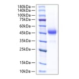 SDS-PAGE - Recombinant Rat ALK-4 Protein (C-terminal Human Fc Tag) (A331446) - Antibodies.com