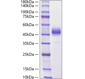 SDS-PAGE - Recombinant Mouse ALK-4 Protein (C-terminal Human Fc Tag) (A331447) - Antibodies.com