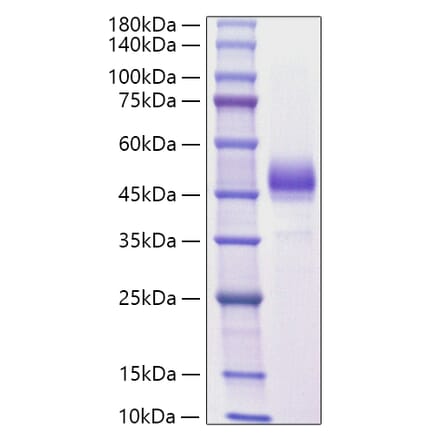 SDS-PAGE - Recombinant Mouse ALK-4 Protein (C-terminal Human Fc Tag) (A331447) - Antibodies.com