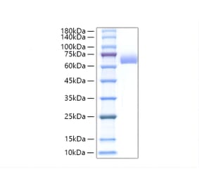 SDS-PAGE - Recombinant Mouse Alkaline Phosphatase Protein (C-terminal His Tag) (A331448) - Antibodies.com