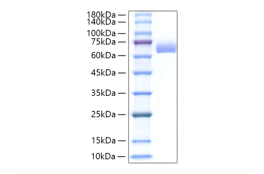 SDS-PAGE - Recombinant Mouse Alkaline Phosphatase Protein (C-terminal His Tag) (A331448) - Antibodies.com