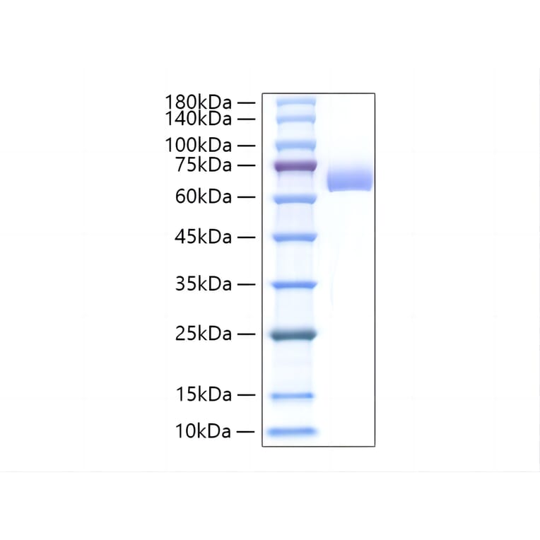 SDS-PAGE - Recombinant Mouse Alkaline Phosphatase Protein (C-terminal His Tag) (A331448) - Antibodies.com