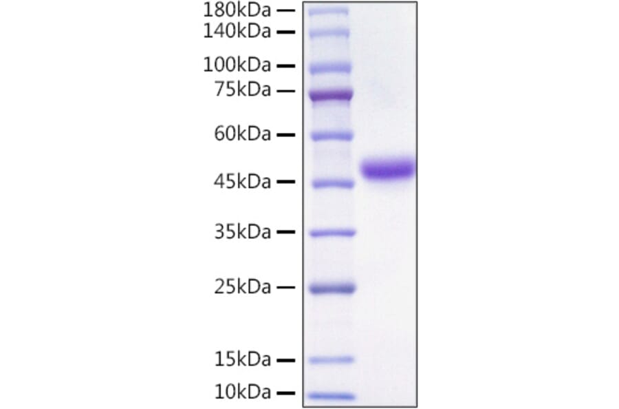 SDS-PAGE - Recombinant Mouse LRPAP1 Protein (C-terminal His Tag) (A331449) - Antibodies.com