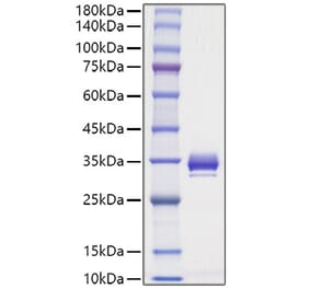 SDS-PAGE - Recombinant Mouse Angiopoietin 1 Protein (C-terminal His Tag) (A331452) - Antibodies.com