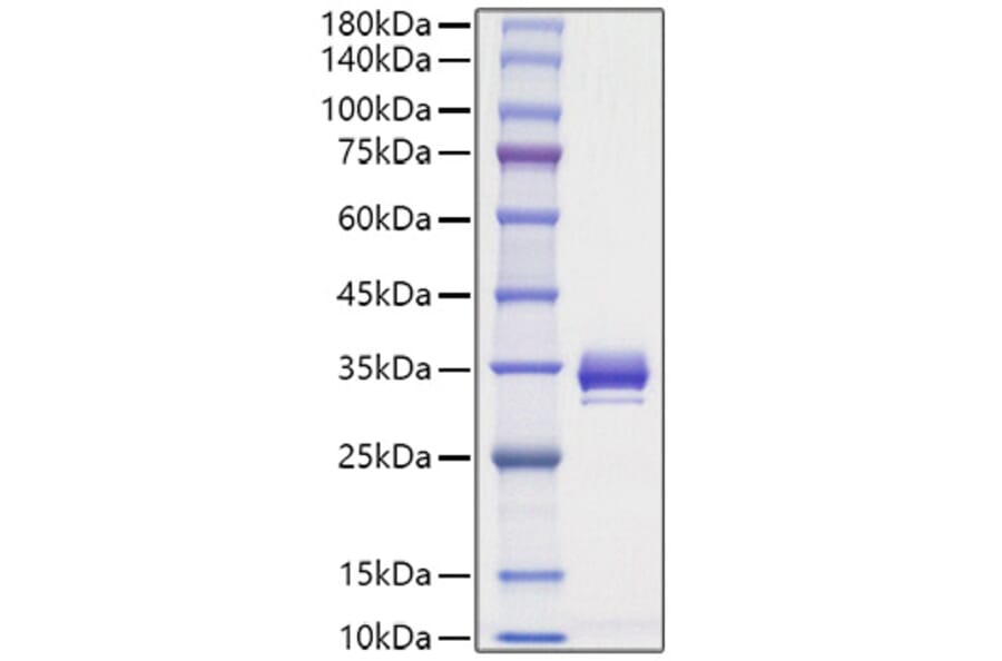 SDS-PAGE - Recombinant Mouse Angiopoietin 1 Protein (C-terminal His Tag) (A331452) - Antibodies.com
