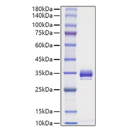 SDS-PAGE - Recombinant Mouse Angiopoietin 1 Protein (C-terminal His Tag) (A331452) - Antibodies.com