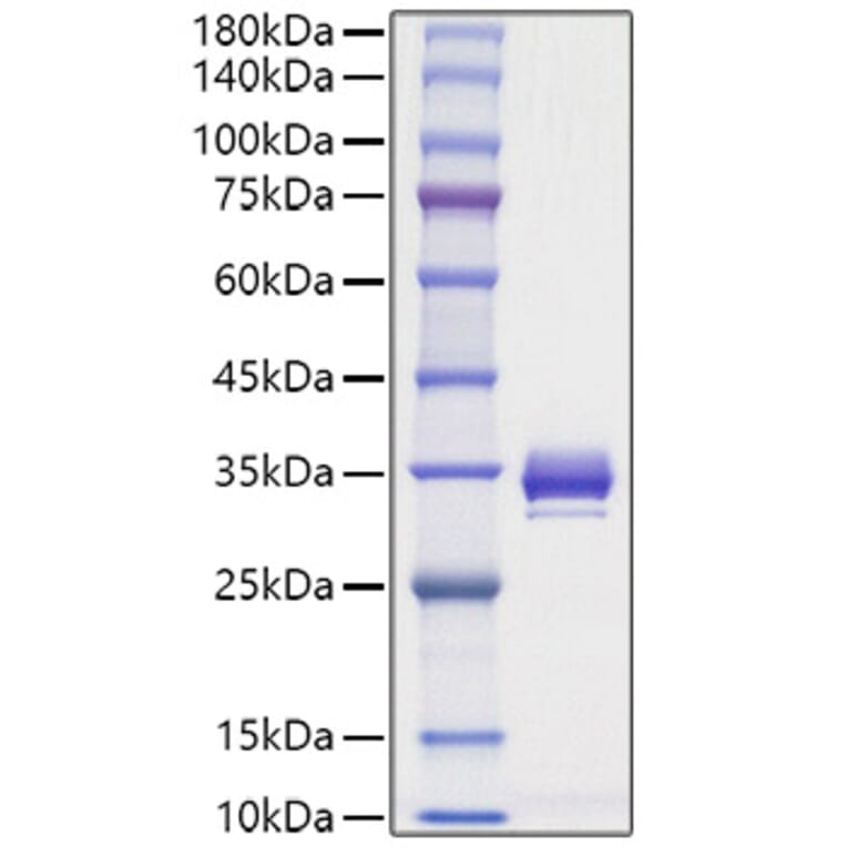SDS-PAGE - Recombinant Mouse Angiopoietin 1 Protein (C-terminal His Tag) (A331452) - Antibodies.com