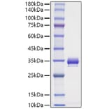 SDS-PAGE - Recombinant Mouse Angiopoietin 1 Protein (C-terminal His Tag) (A331452) - Antibodies.com