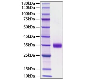 SDS-PAGE - Recombinant Mouse Angiopoietin 2 Protein (C-terminal His Tag) (A331453) - Antibodies.com