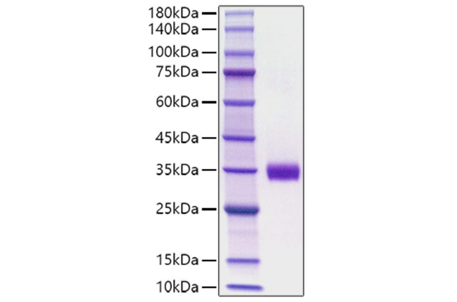 SDS-PAGE - Recombinant Mouse Angiopoietin 2 Protein (C-terminal His Tag) (A331453) - Antibodies.com