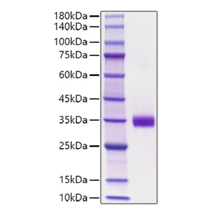 SDS-PAGE - Recombinant Mouse Angiopoietin 2 Protein (C-terminal His Tag) (A331453) - Antibodies.com