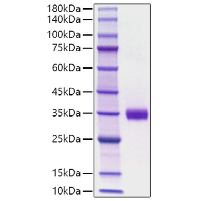 SDS-PAGE - Recombinant Mouse Angiopoietin 2 Protein (C-terminal His Tag) (A331453) - Antibodies.com