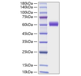 SDS-PAGE - Recombinant Mouse Angiotensinogen Protein (C-terminal His Tag) (A331454) - Antibodies.com