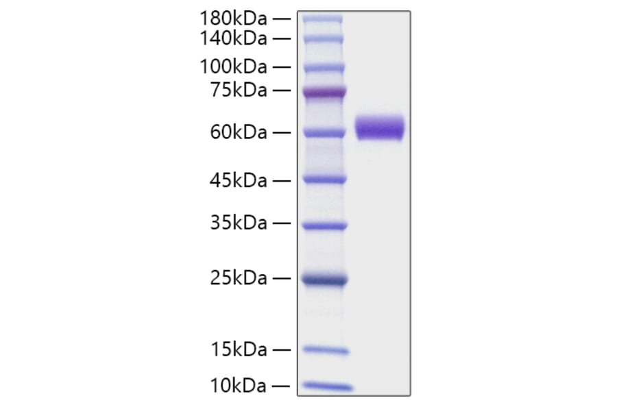 SDS-PAGE - Recombinant Mouse Angiotensinogen Protein (C-terminal His Tag) (A331454) - Antibodies.com