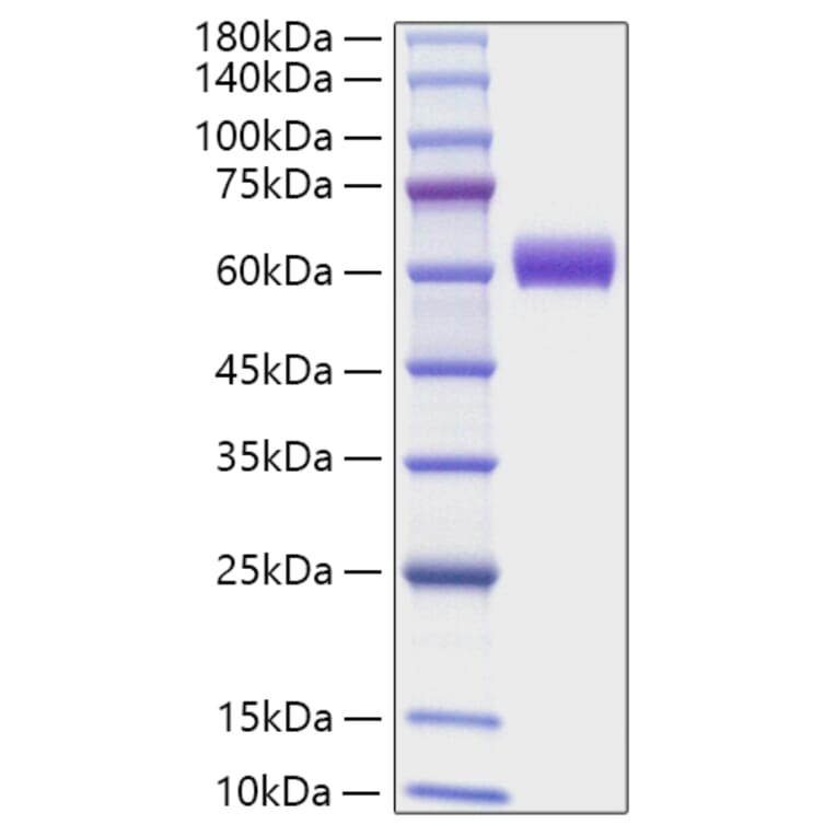 SDS-PAGE - Recombinant Mouse Angiotensinogen Protein (C-terminal His Tag) (A331454) - Antibodies.com