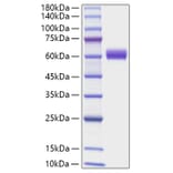SDS-PAGE - Recombinant Mouse Angiotensinogen Protein (C-terminal His Tag) (A331454) - Antibodies.com
