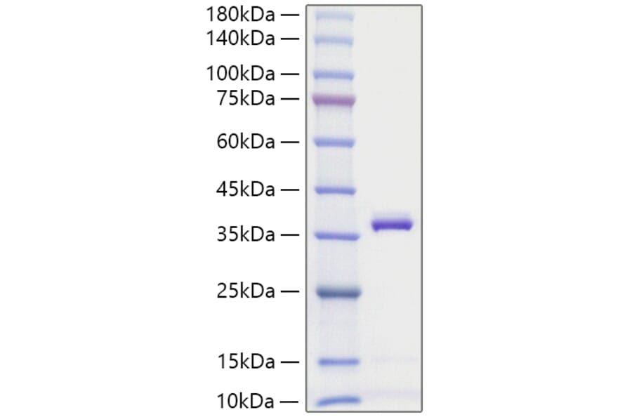 SDS-PAGE - Recombinant Mouse APOE Protein (C-terminal His Tag) (A331456) - Antibodies.com