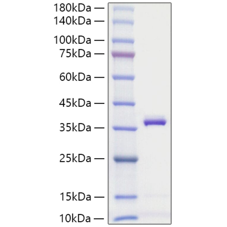 SDS-PAGE - Recombinant Mouse APOE Protein (C-terminal His Tag) (A331456) - Antibodies.com