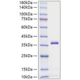 SDS-PAGE - Recombinant Mouse APOE Protein (C-terminal His Tag) (A331456) - Antibodies.com