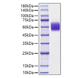 SDS-PAGE - Recombinant Mouse APOH Protein (C-terminal His Tag) (A331457) - Antibodies.com