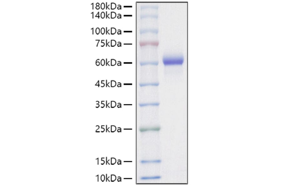 SDS-PAGE - Recombinant Mouse Legumain Protein (C-terminal His Tag) (A331458) - Antibodies.com