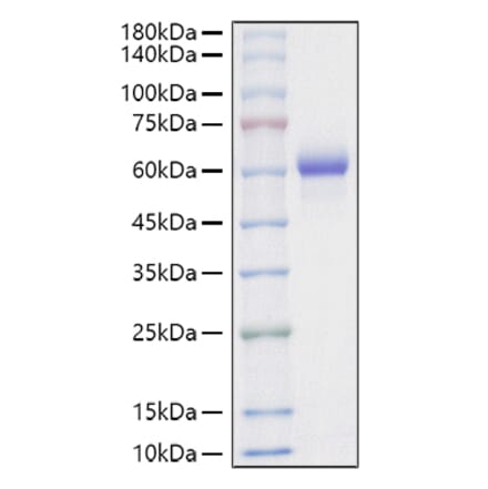 SDS-PAGE - Recombinant Mouse Legumain Protein (C-terminal His Tag) (A331458) - Antibodies.com