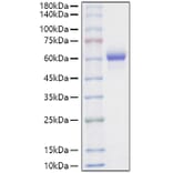 SDS-PAGE - Recombinant Mouse Legumain Protein (C-terminal His Tag) (A331458) - Antibodies.com