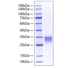 SDS-PAGE - Recombinant Mouse Fibrillin 1 Protein (N-terminal His Tag) (A331459) - Antibodies.com