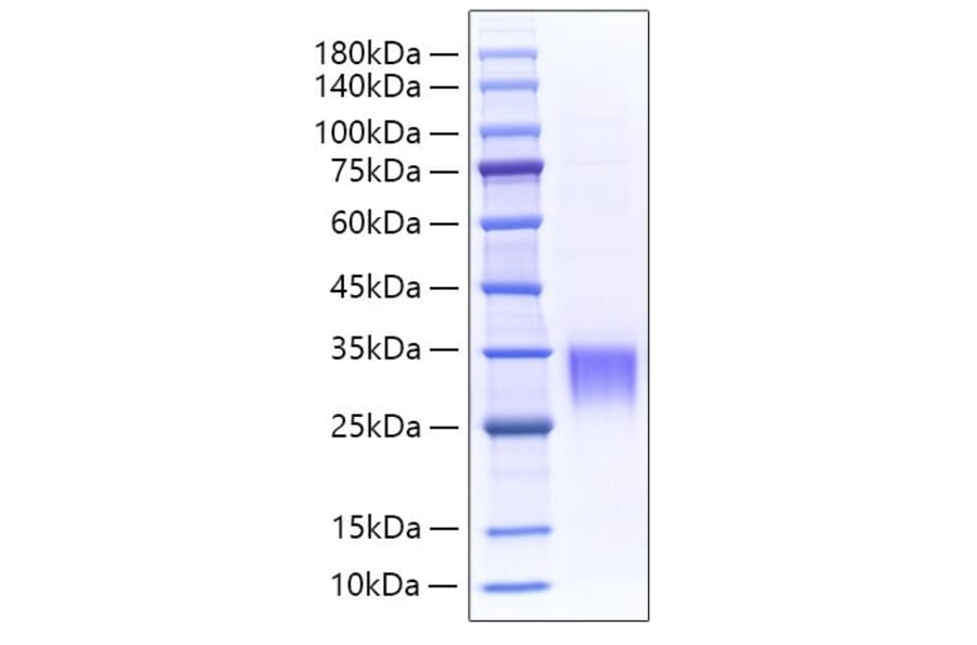 SDS-PAGE - Recombinant Mouse Fibrillin 1 Protein (N-terminal His Tag) (A331459) - Antibodies.com