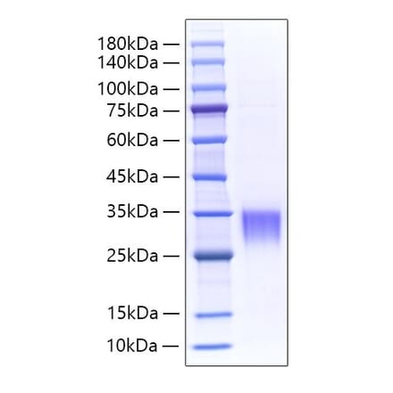 SDS-PAGE - Recombinant Mouse Fibrillin 1 Protein (N-terminal His Tag) (A331459) - Antibodies.com