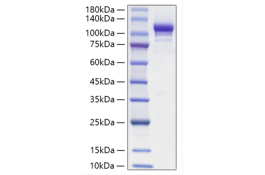 SDS-PAGE - Recombinant Mouse ENPP2 Protein (C-terminal His Tag) (A331460) - Antibodies.com