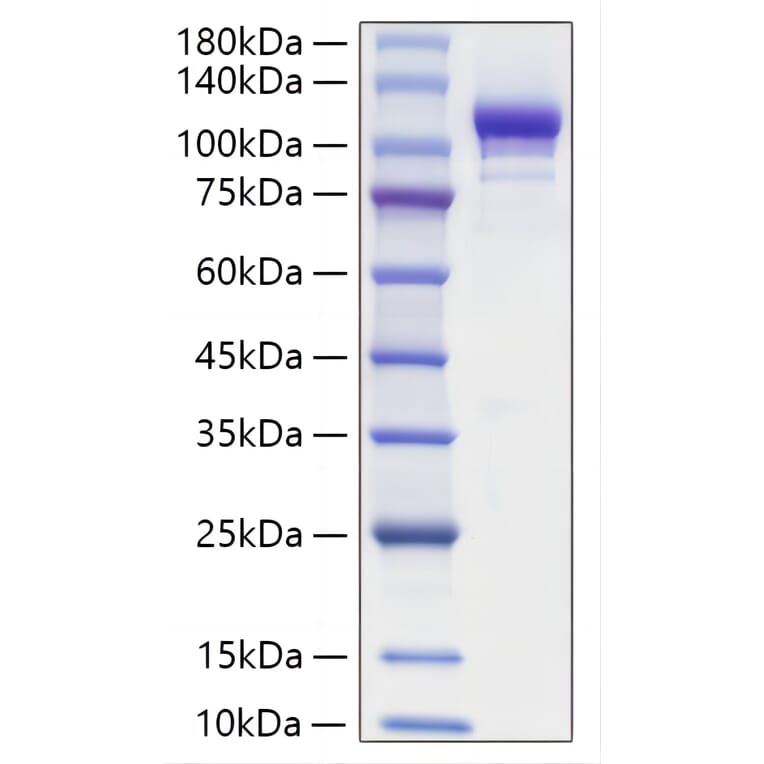 SDS-PAGE - Recombinant Mouse ENPP2 Protein (C-terminal His Tag) (A331460) - Antibodies.com
