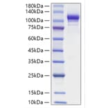 SDS-PAGE - Recombinant Mouse ENPP2 Protein (C-terminal His Tag) (A331460) - Antibodies.com