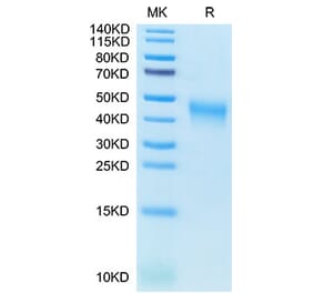 Tris-Bis PAGE - Recombinant Cynomolgus macaque CD80 Protein (C-terminal His Tag) (A331461) - Antibodies.com