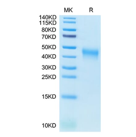 Tris-Bis PAGE - Recombinant Cynomolgus macaque CD80 Protein (C-terminal His Tag) (A331461) - Antibodies.com